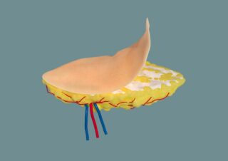 長庚醫院 Medical Animations